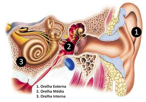 Otosclerose Ilustração Médica Orelha Interna Orelha Media