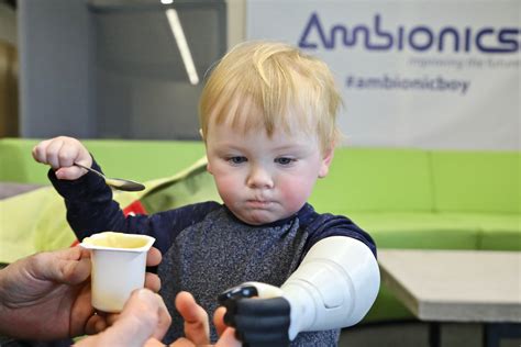 Welsh Father Invents 3d Printed Hydraulic Arm For His Toddler To