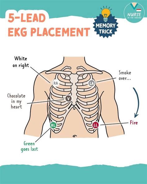 Ekg Placement Nursing School Essential Nclex Review Nclex Study