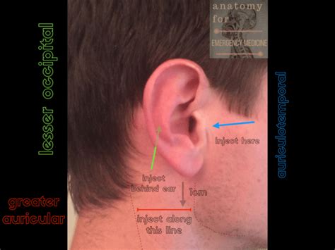 045 Sensory Innervation Of The Ear Anatomy For Emergency Medicine
