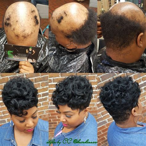 Alopecia Hairstyles