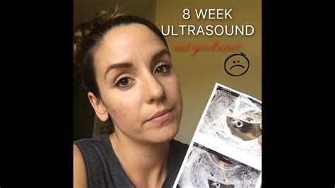 Possible Miscarriage 8 Week Ultrasound Youtube