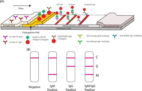 Development and clinical application of a rapid IgM‐IgG combined antibody test for SARS‐CoV‐2 ...
