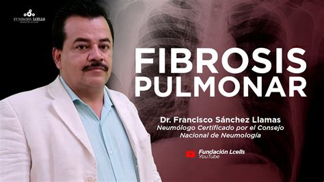 Fibrosis Pulmonar Qu Es C Mo Se Diagnostica Hay Tratamientos