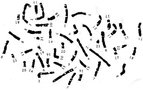 Human chromosomes lab 5 objectives upon completion of this activity, you should be able to 14. 11 Best Images of Karyotype Worksheet Answers - Human ...