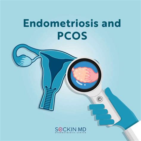 endometriosis and pcos seckin endometriosis center