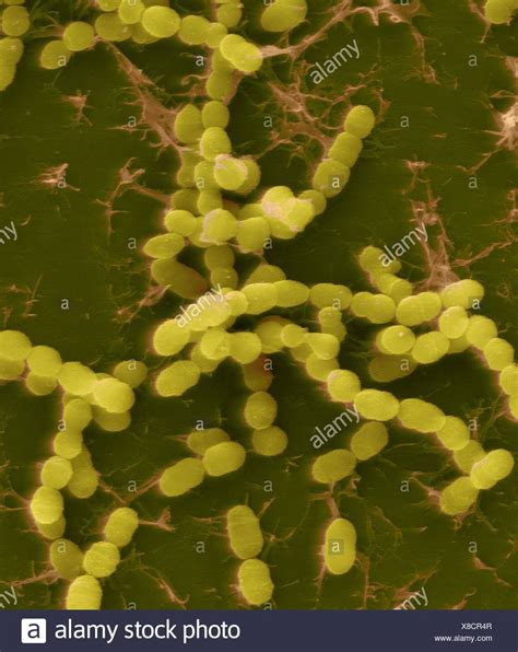 Color Análisis Micrografía De Electrones Sem De Streptococcus