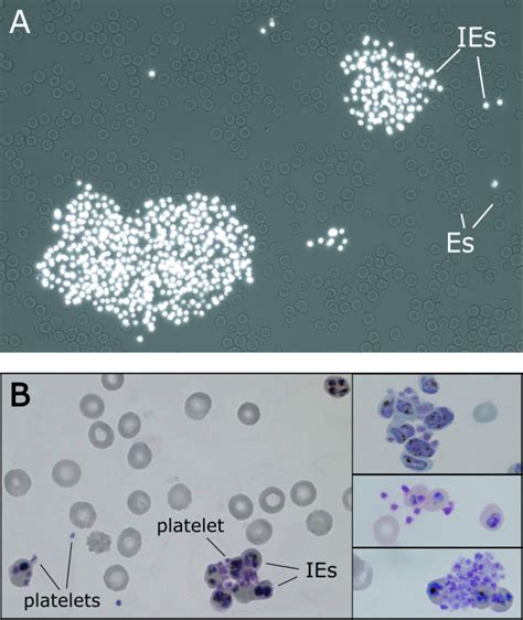 Platelet Mediated Clumps Of P Falciparum Infected Erythrocytes Ie