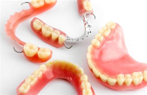 Precio De Prótesis Dentales Removibles En México
