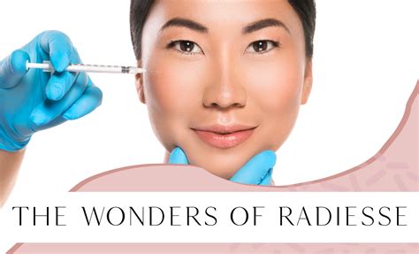 The Wonders Of Radiesse — Pretty Please Aesthetics