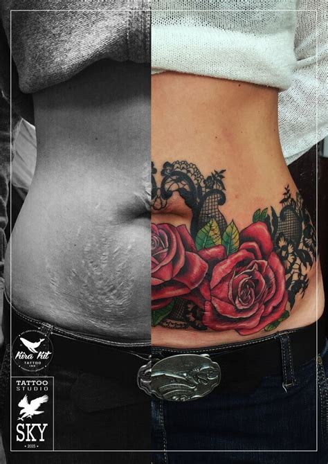 Tummy Tuck Tattoo Cover Ups Pictures