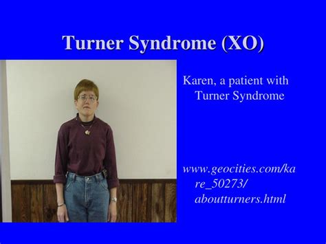 Male Turner Syndrome
