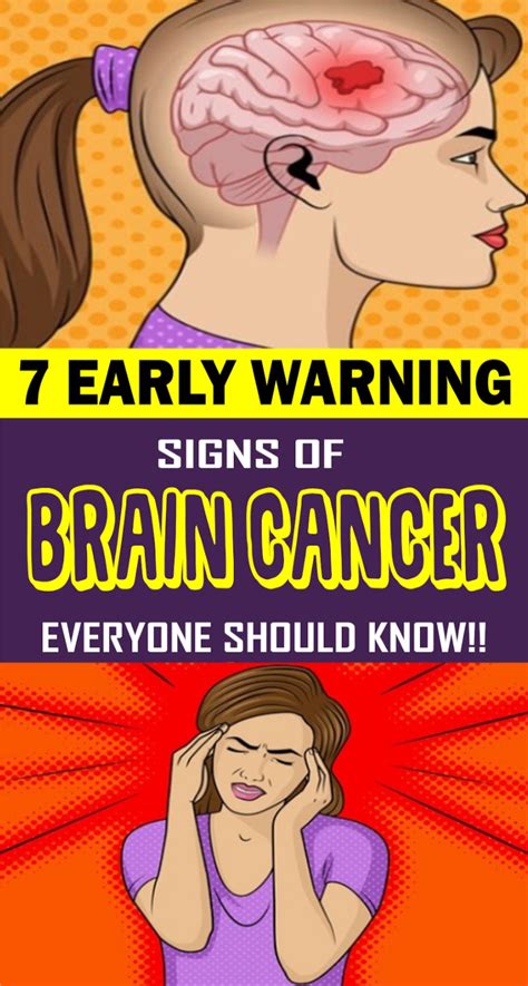 7 Early Warning Signs Of Brain Cancer Everyone Should Know Healthy