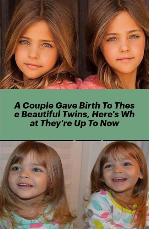 A Couple Gave Birth To These Beautiful Twins Here S What They Re Up To