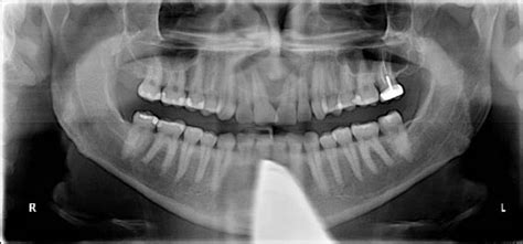Com April 2010 Diagnosis Uw School Of Dentistry