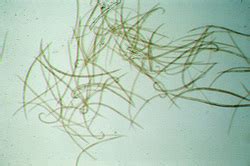 Nematoda - Reproductive System