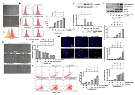 P gingivalis up regulates ROS and NF κB activation and increases the