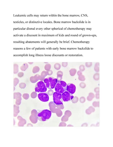 Acute Myeloid Leukemia Pathology Leukemic Cells May Return Within The