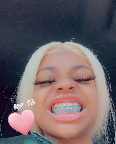 𝐹𝑜𝑙𝑙𝑜𝑤𝑄𝑢𝑒𝑒𝑛𝑠💕 Cute Braces Colors Cute Braces Braces Colors