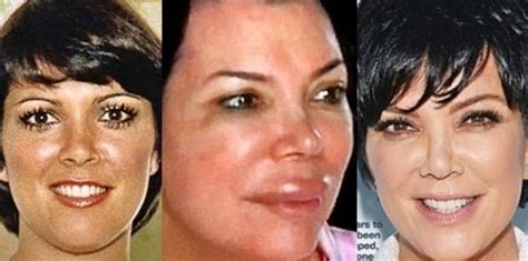 Kris Jenner Perfect Plastic Surgery For 59 Years Old Mother