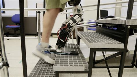 The Future Of Prosthetics Could Be This Brain Controlled