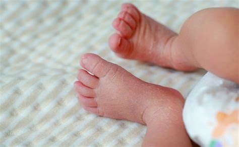 Premium Photo Close Up Feet Of A Newborn With Peeling Skin