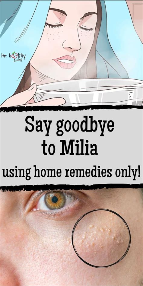 Say Goodbye To Milia Using Home Remedies Only Nighttime Skincare