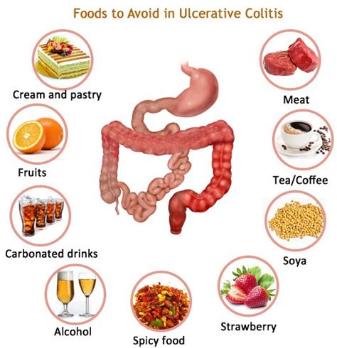 16 Best Images About Best Ulcerative Colitis On Pinterest Drinks