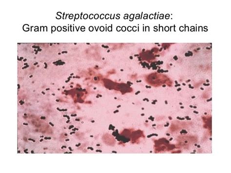Streptococcus Agalactiae Group B Strep Beta Hemolysis Bacitracin
