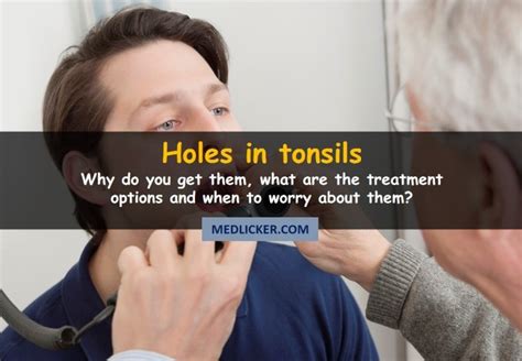 Holes In Tonsils What Are They And How To Get Rid Of Them