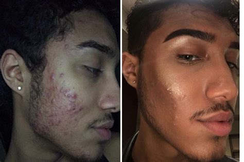 Makeup Artist Swears No7 Facial Serum Cleared Up His Acne Before And