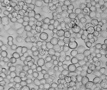 Culturing Insect Cells - OET BlogOxford Expression ...