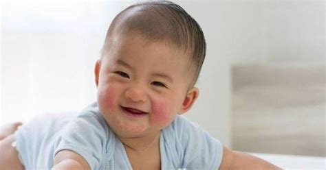 Keluhan mengenai bintik merah pada muka atau kepala bayi ini disebut dermatitis atopik moms. Cara Menghilangkan Bintik Merah Pada Kulit Bayi Baru Lahir ...