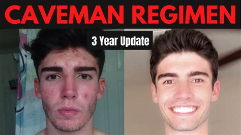 Caveman Regimen Cured My Cystic Acne Caveman Regimen 3 Year Update