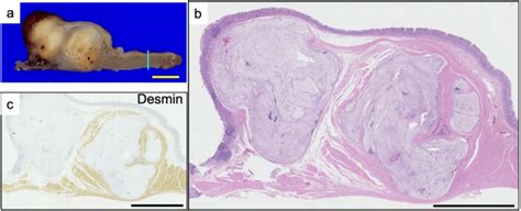 Macroscopic View Of The Tumor A Hematoxylin Eosin Staining Revealing