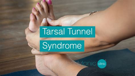 Managing Your Tarsal Tunnel Syndrome Symptoms Tarsal Tunnel Syndrome My XXX Hot Girl