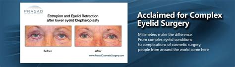 eyelift surgery specialist dr amiya prasad new york