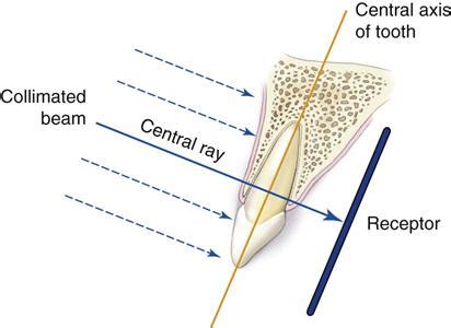 7 Intraoral Projections Pocket Dentistry