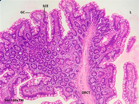 An Overview Of The Small Intestine Histologyolm Stevegallik Org My Xxx Hot Girl