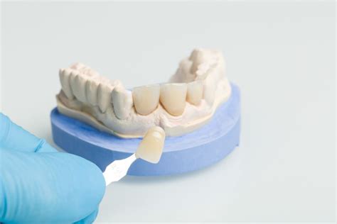 Veneers Vs Dentures Which To Choose Dr Alex Midtown Nyc Cosmetic