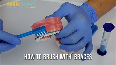How To Brush With Braces Tips And Tricks Youtube