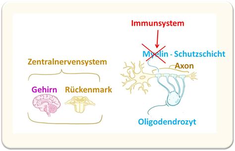 Multiple sclerosis is a disease that causes demyelination of the brain and spinal cord nerve cells. Multiple Sklerose - Krankheit der tausend Gesichter ...