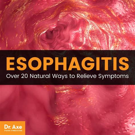 Esophagitis Causes Symptoms Natural Self Care Dr Axe