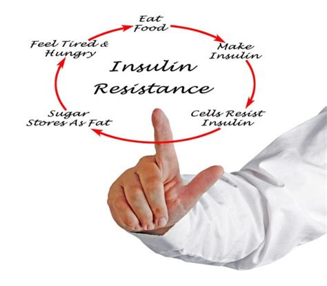 Type 2 diabetes is the most common form of diabetes mellitus, which is a group of diseases associated with high blood sugar, called hyperglycemia. Insulin Resistance Causes and Symptoms