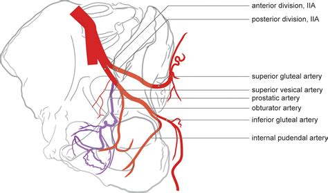 Prostatic Artery Embolization For Benign Prostatic Hyperplasia Patient Evaluation Anatomy And