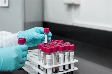 Researchers Claim New Blood Test Can Find 50 Types Of Cancer Steamdaily
