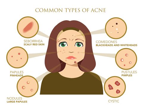 Types Of Spots On Face