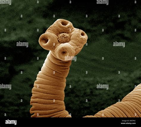 Tapeworm Cestoda Scolex Sem Hi Res Stock Photography And Images Alamy