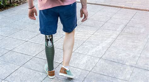 Learn How To Walk With A Prosthetic Limb Orthopedic Appliance Company