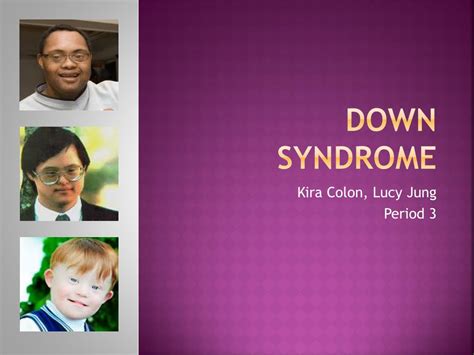 Ppt Down Syndrome Powerpoint Presentation Free Download Id5880235